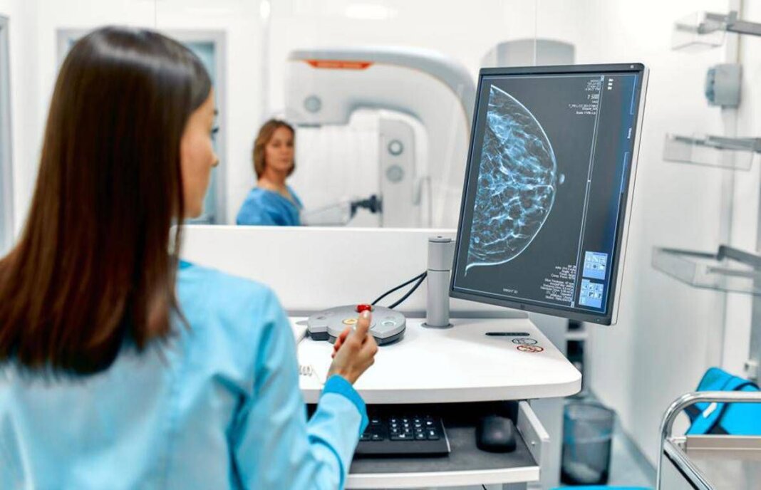 Europa Donna: “Grazie al Governo per impegno estensione screening mammografico”